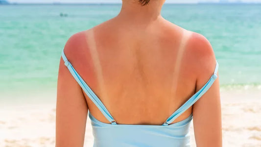 🌞 Top 5 des erreurs qui empêchent un bronzage uniforme (et comment les éviter !)